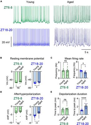 Age-Related Unstructured Spike Patterns and Molecular Localization in Drosophila Circadian Neurons